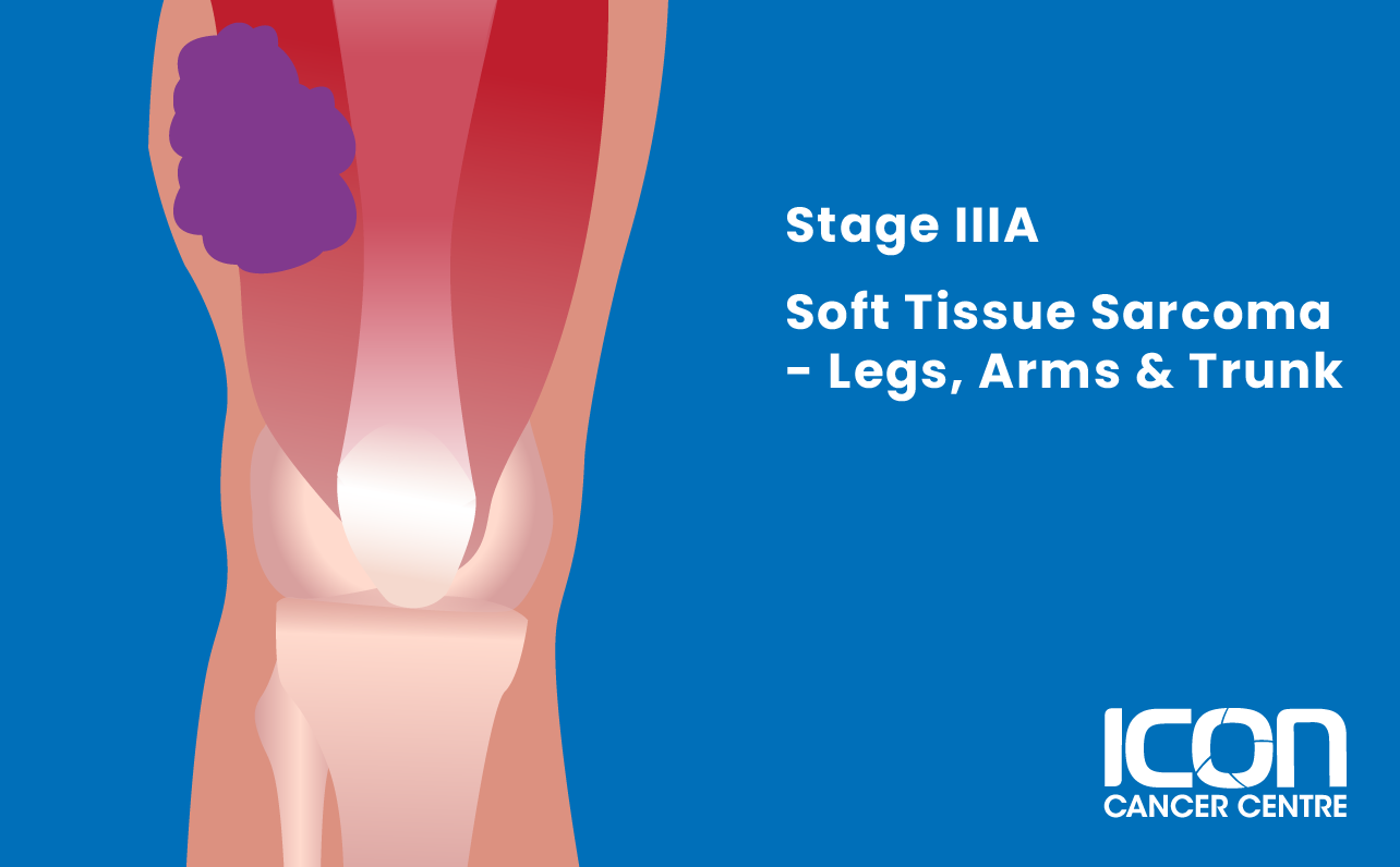 Stage IIIA soft tissue sarcoma in arms, legs and trunk illustration